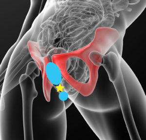Areas of perineum prone to chafing